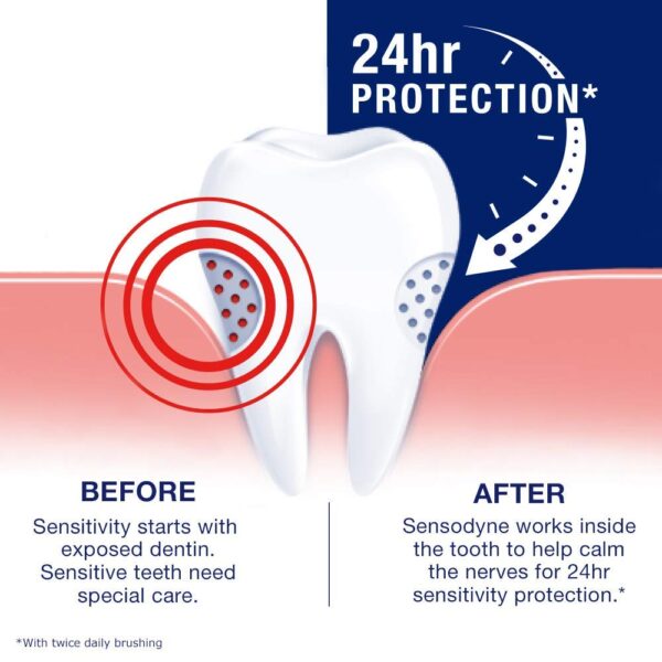 Sensodyne Full Protection Plus Whitening Toothpaste 113g - Image 8